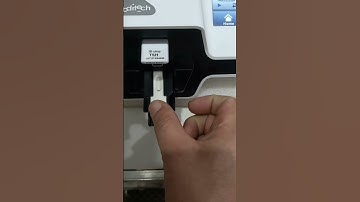 TSH test | Thyroid test | ichroma II | hypothyroidism | hyperthyroidism | Biochemistry