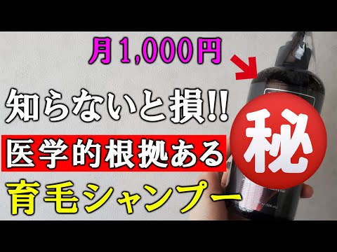 月1000円で買える現時点で最強の育毛シャンプーを買ってみた
