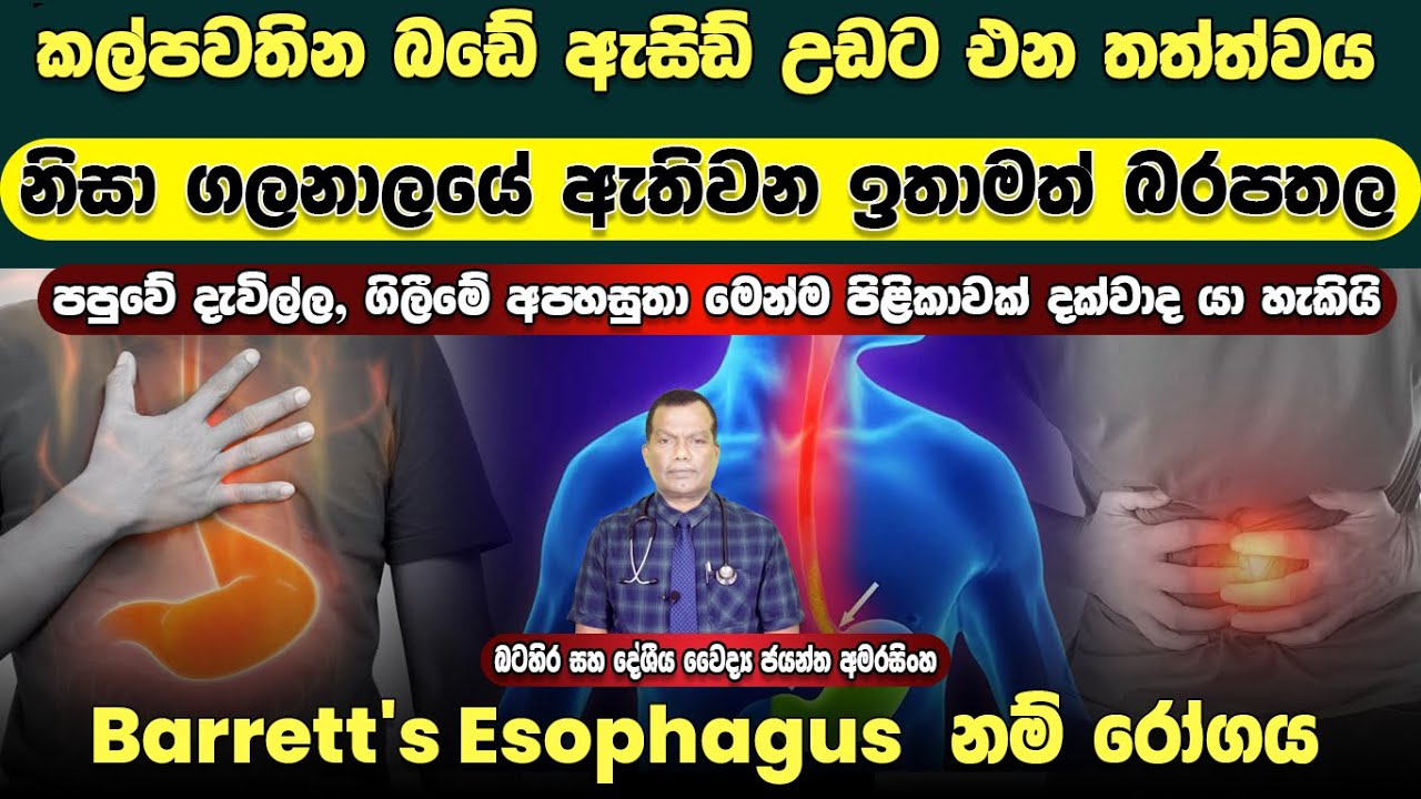කල්පවතින බඩේ ඇසිඩ් උඩට එන තත්ත්වය නිසා ගලනාලයේ ඇතිවන ඉතා බරපතල තත්ත්වයක් වන Barrett's Esophagus රෝගය