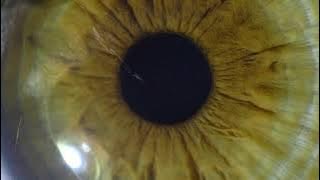 PHI NIX & Hoober - Overdosin