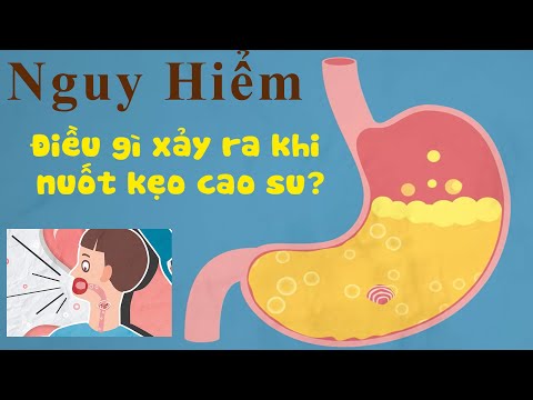 Video: Phải Làm Gì Nếu Trẻ Nuốt Kẹo Cao Su