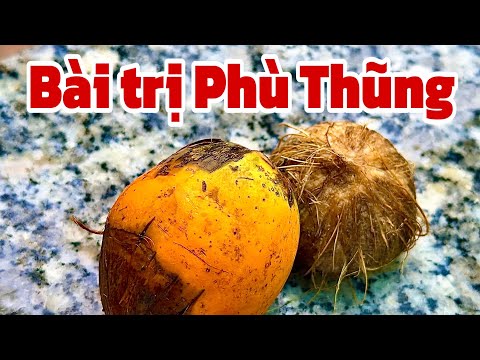 Bài trị Phù Thũng . PHAN HẢI Channel 