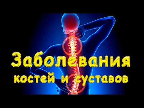 Заболевания костей и суставов