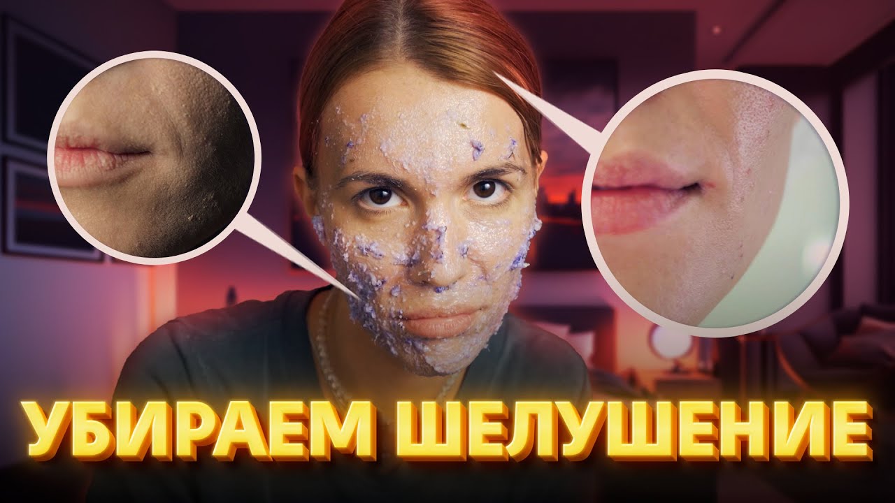 Как убрать шелушение?