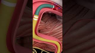 Stroke Treatment Mechanical Thrombectomy  Medical Animation Enhanced Version #Ischemicstroke