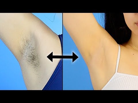 My ARMPIT ROUTINE | Hair Removal & Preventing Dark Underarms