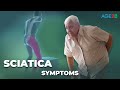 Sciatica Symptoms