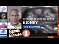 Ultrasound imaging of the kidneys  dr s boopathy  anatomy variations tips and tricks on usg