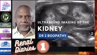 ULTRASOUND IMAGING OF THE KIDNEYS || DR S BOOPATHY || ANATOMY, VARIATIONS, TIPS AND TRICKS ON USG