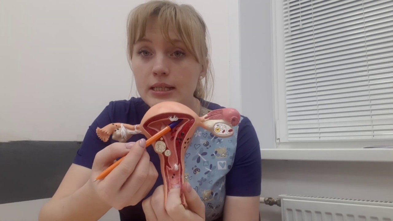 Как сделанный аборт может повлиять на следующую беременность. Акушер ...