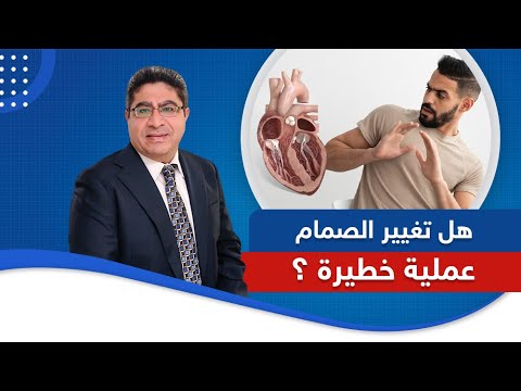 هل تغيير الصمام عملية خطيرة دكتور اسامة عباس