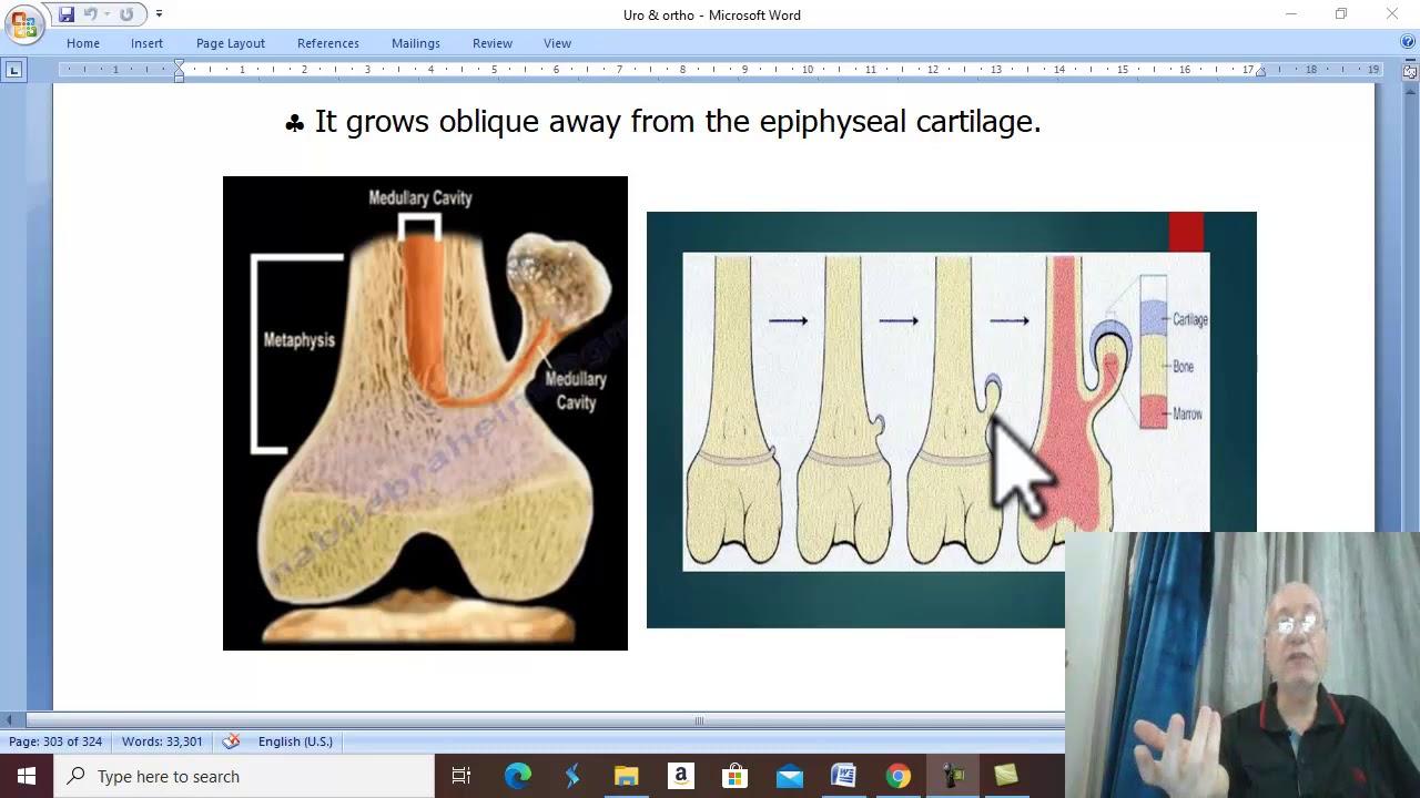 Orthopaedic in Arabic 55  ( Osteochondroma ) , by Dr.Wahdan