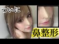 【整形】FF顔になりたい【話題の〇〇】