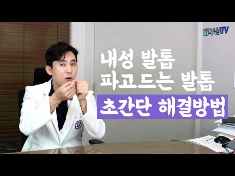 3분피부꿀팁! 내성발톱 제거 초간단 치료방법