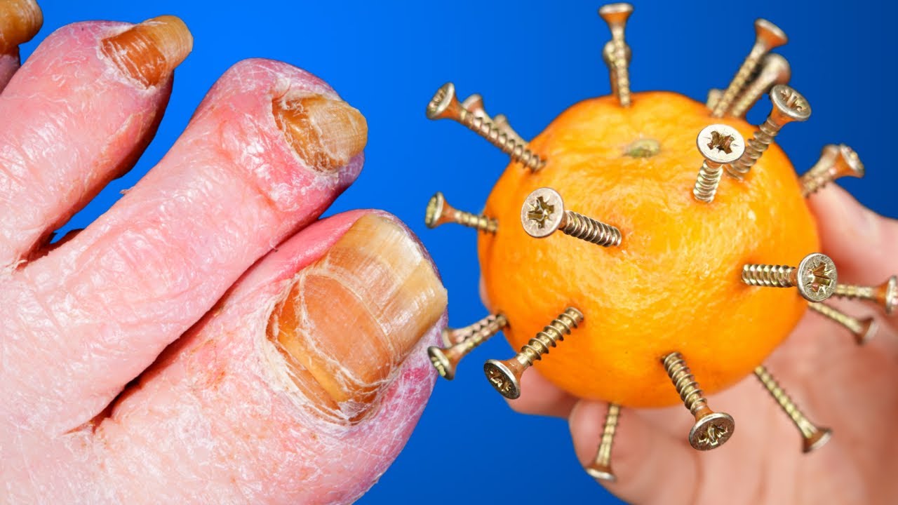 Peclavus AntiMYX Protectorstift Gegen Nagelpilz Und Verfärbung Kaufen
