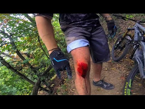 QUANDO si DIMENTICANO le GINOCCHIERE- Bici-Vlog #3