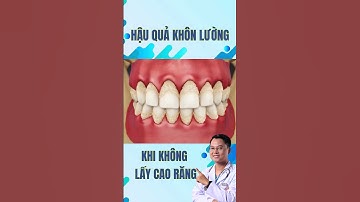 Hậu quả khôn lường khi KHÔNG LẤY CAO RĂNG? #drcuong #nhakhoa #niengrang