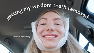 GETTING MY WISDOM TEETH REMOVED (day 1-7)