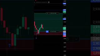 #trading #scalpingtradingstrategy #december6th #ethereum #stockmarket #nifty #tradingstockmarket