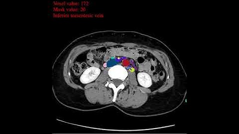 Abdominal vasculature - manual segmentation, highly detailed