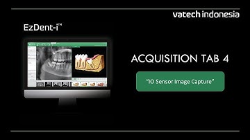 EzDent-i: "Acquisition Tab 4: IO Sensor Image Capture"