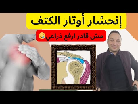 اختناق و انحشار أوتار الكتف متلازمة ارتطام الكتف  