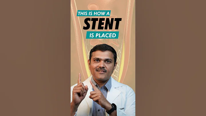 Angioplasty Explained: A Step-by-Step Guide to Vascular Health