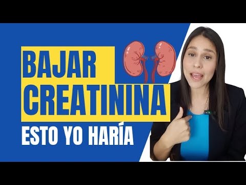 Esto es lo