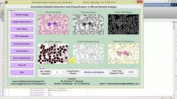 Malaria Detection from Blood Cell Images Using Image Processing
