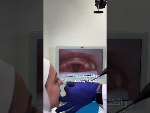 علاج اللحميات و الأكياس على الأحبال الصوتية