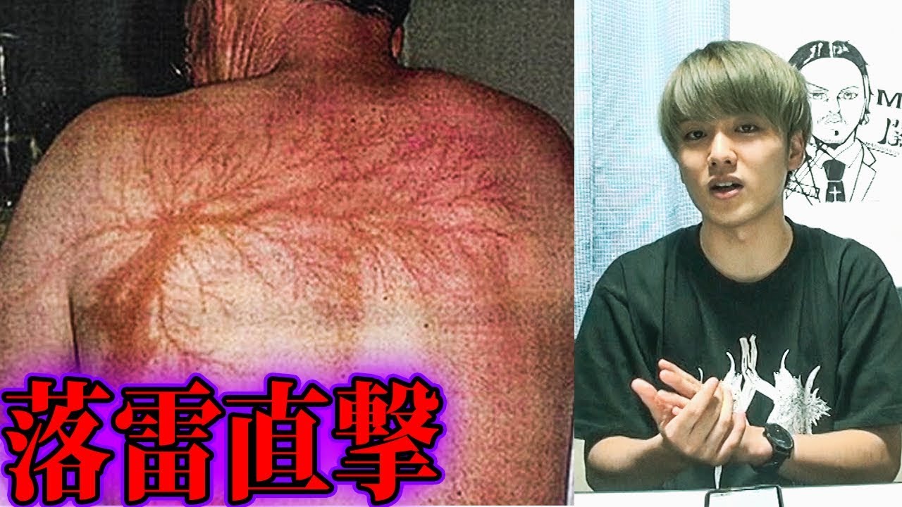 10回落雷に直撃しても生還した老人 衝撃 Youtube 10回落雷に直撃しても生還した老人 衝撃 Youtube