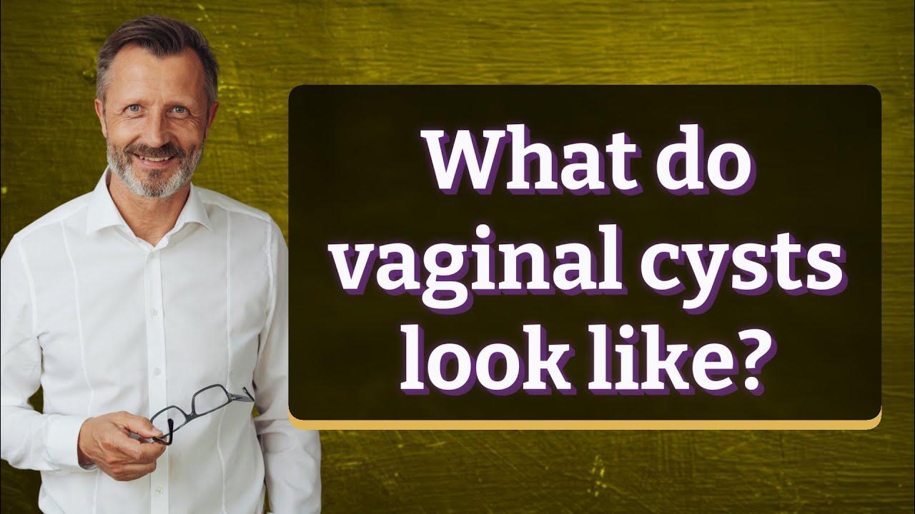 What do vaginal cysts look like youtube