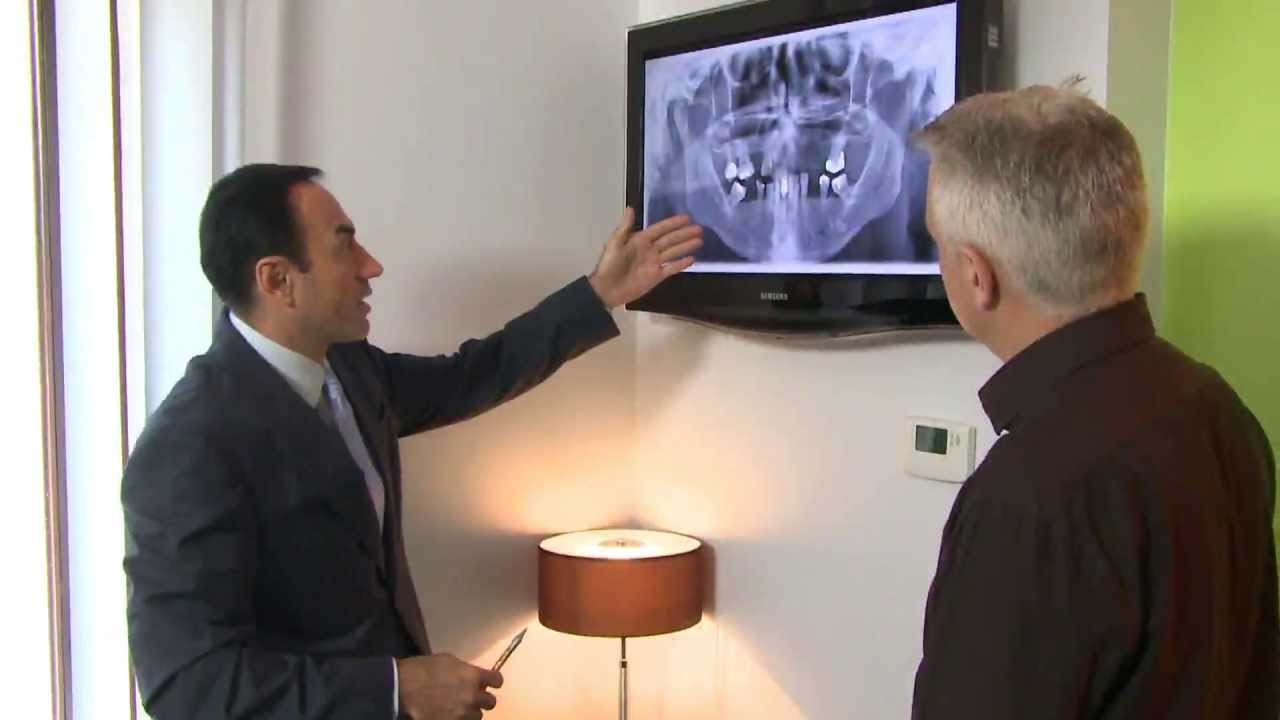 Dental Implant Center Hungary Film