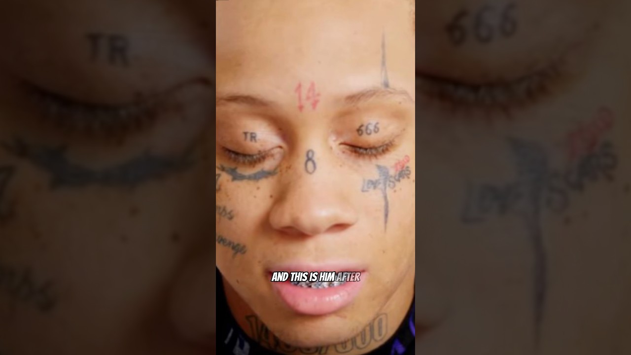 Before and after they 