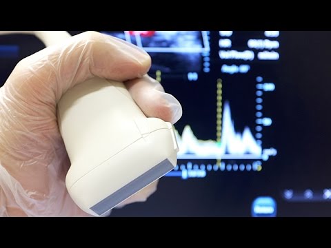 Renkli Doppler Ultrasonografi Nasıl Çekilir?