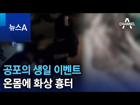 공포의 생일 이벤트…온몸에 <strong>화상</strong> <strong>흉터</strong> | 뉴스A