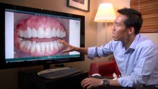 Advanced Dental Artistry Treatment from Start to Finish Perth Cosmetic and Denta