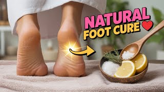 Natural Foot Cure That Heals Cracked Feet Fast No Expensive Creams