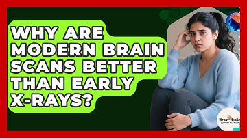 Why Are Modern Brain Scans Better Than Early X-rays? - Brain Health Support Network