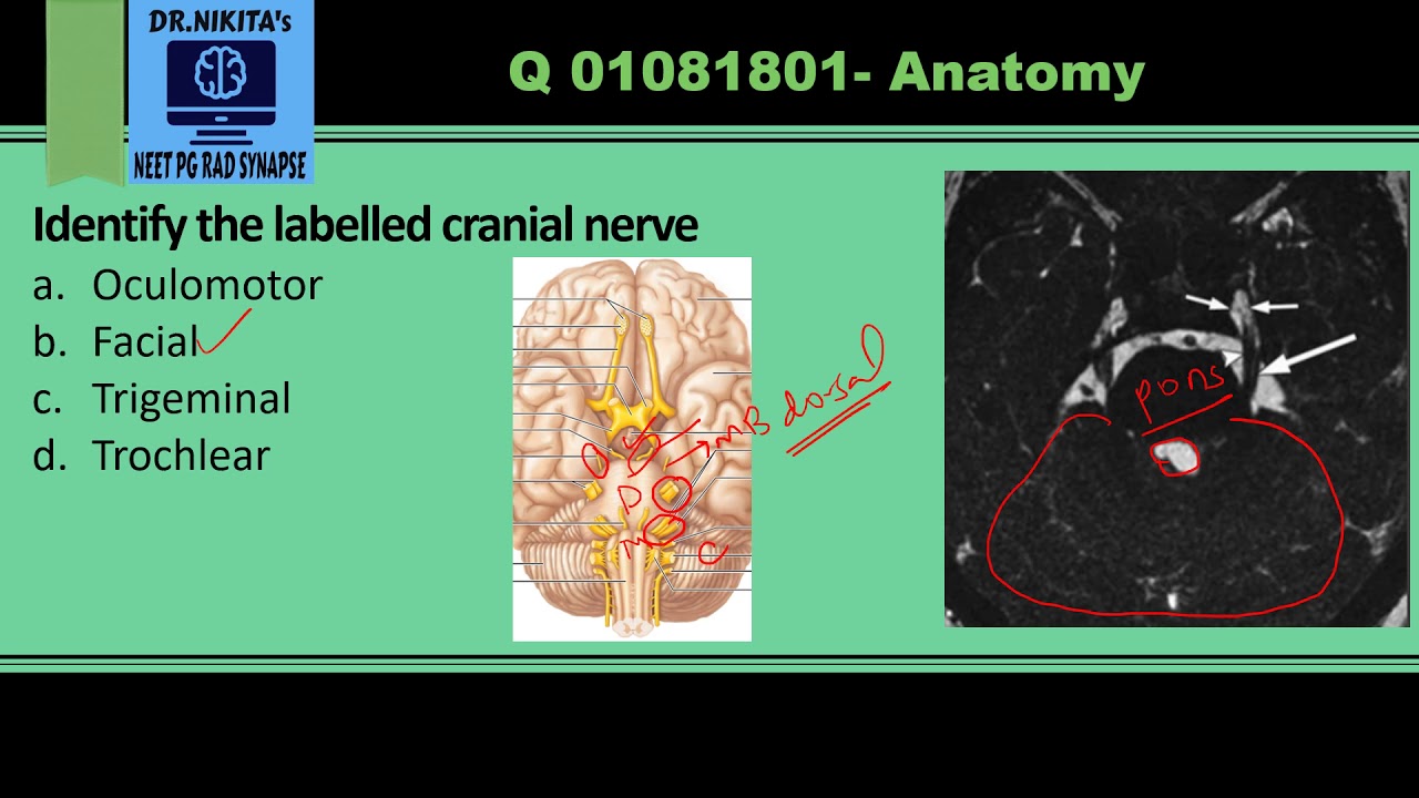 Cranial nerves anatomy and identification MRI YouTube