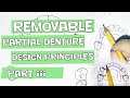 Removable partial denture design principles part iii