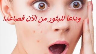 ?روتين جد رائع لعلاج حبوب الوجه بسرعه?