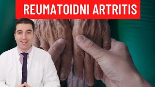 savjeta artritis liječenje
