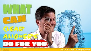 What can clear aligners do for you and what are the limits of Invisalign?