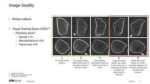 FIDELIO Webinar - Cracking Bone: High-Resolution Imaging Meets Computational Mechanics