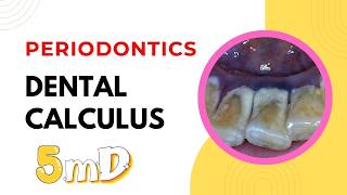 PERIODONTICS - DENTAL CALCULUS easy lecture - BDS