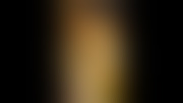 Proximal Sub-Pectoral Biceps Tenodesis Demonstration