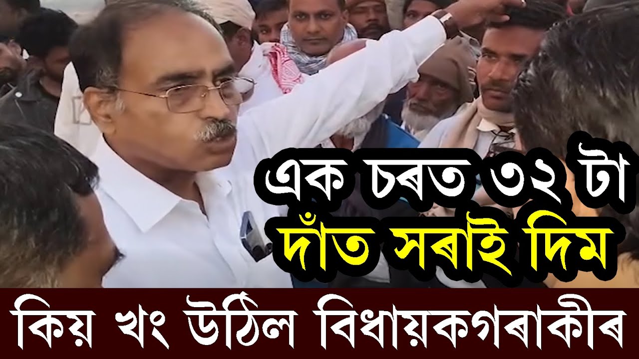 এক চৰত ৩২ টা দাঁত সৰাই দিম | Sherman Ali Ahmed