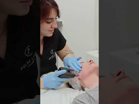 Surviving Morpheus8's Painful Treatment