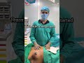 Grade 2 Gynecomastia में डॉक्टर ये क्यों करते हैं #surgical #technique